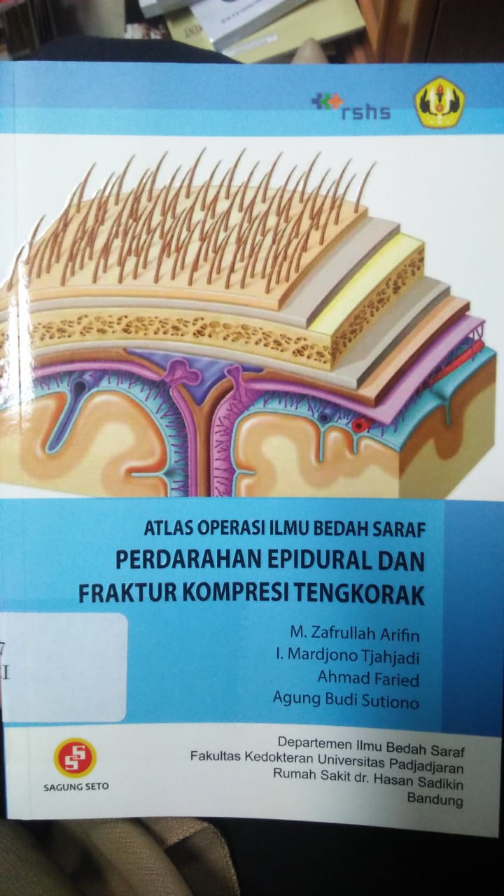 Cover ATLAS OPERASI ILMU BEDAH SARAF PERDARAHAN EPIDURAL DAN FRAKTUR KOMPRESI TENGKORAK / Zafrullah Arifin