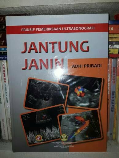 Cover PRINSIP PEMERIKSAAN ULTRASONOGRAFI JANTUNG JANIN / Adhi pribadi